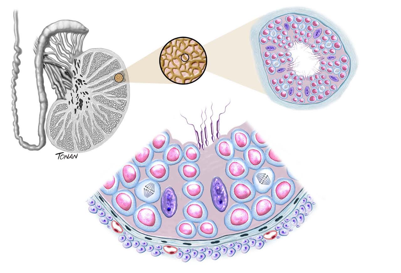 Azoospermia