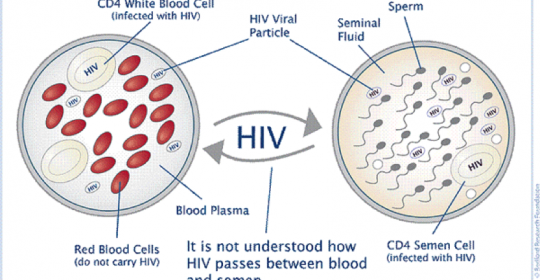 A carga viral do HIV indetectável no sangue não significa carga