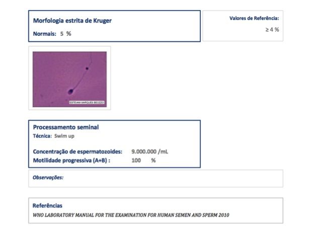 laudo de espermograma com o processamento seminal