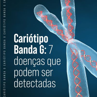 Cariótipo Banda G